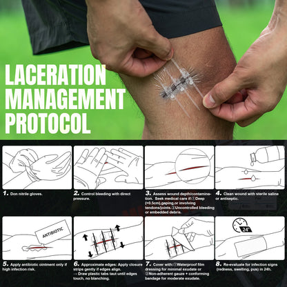 Rhino Rescue Zip-Stitch Wound Kit | Needle-Free Laceration Closure strips