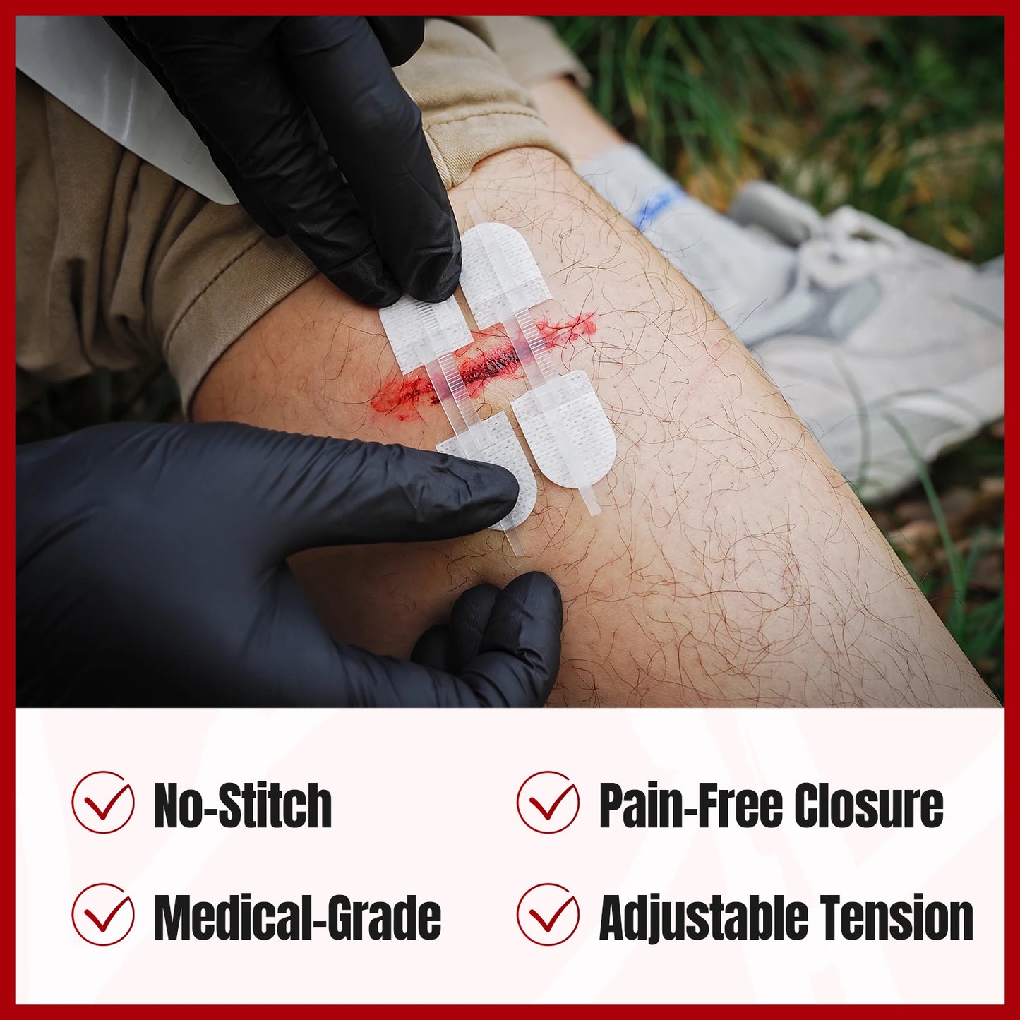Rhino Rescue Zip-Stitch Wound Kit | Needle-Free Laceration Closure strips